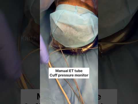 ET tube cuff