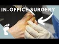 IN OFFICE SURGERY | TWO procedures in one