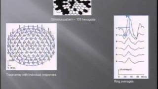 Multifocal Electroretinography and Genetic Correlations in Early Age-Related Macular Degeneration