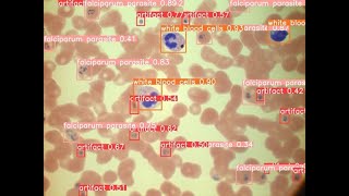 AI-Integrated Web App Software for Microscopic Detection and Quantification of Malaria Parasites screenshot 2