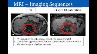 Introduction to Radiology: Magnetic Resonance Imaging screenshot 3