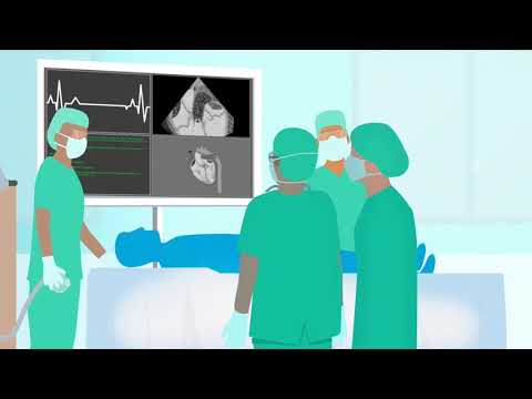 TAVI procedure vervanging aortaklep