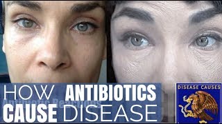 How to Deal With Antibiotic Reactions - Restore Gut After Taking Antibiotics