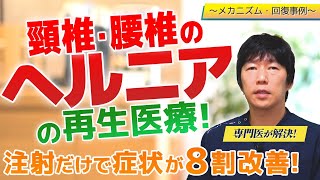 【ヘルニアの再生医療】驚異の回復！頚椎・腰椎のヘルニアの症状と幹細胞治療の症例を紹介！【医師が解説】