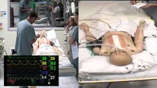 Famous Complete Heart Block Simulation - Epicardial Pacing Net Worth