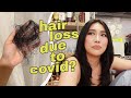 Unexpected EXCESSIVE HAIR FALL after COVID? 😥 | Raiza Contawi