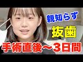 【激痛】小6の親知らず手術直後〜３日間に密着！【抜歯】
