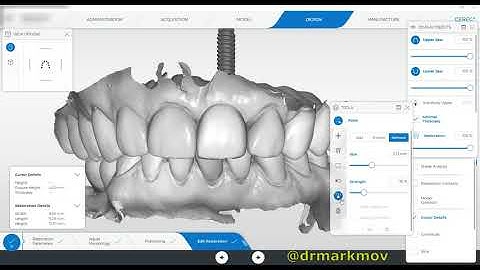 Cerec Multilayer Design - Mirroring Central Incisor Manually