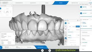 Cerec Multilayer Design - Mirroring Central Incisor Manually