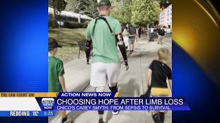 Wellness Wednesday - Chico dad athlete loses limbs to rare infection refuses to give up
