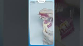Niềng Răng Ăn Gì ? | Bác Sĩ Yên