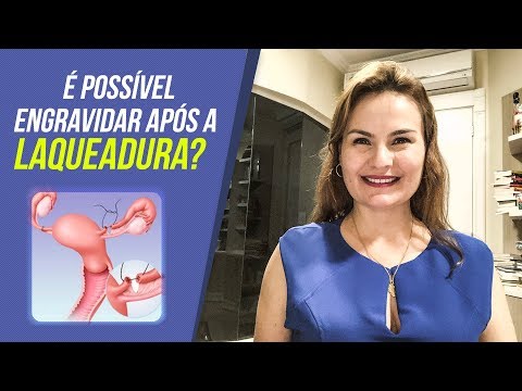 Vídeo: Por que as laqueaduras falham?