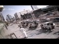 Head Injury Surprise For Young Man in Saudi Arabia