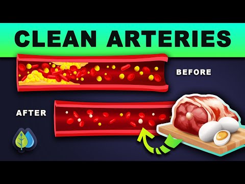 ❣️Top 10 Foods that Unclog Arteries Naturally and Prevent Heart Attack