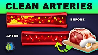 ❣️top 10 foods that unclog arteries naturally and prevent heart attack