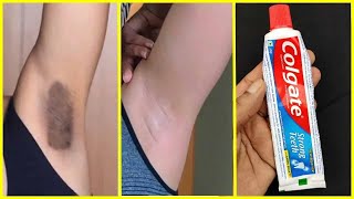 How To Get Rid Of Dark Underarms With Toothpaste - Whitening Underarm Best Remedy