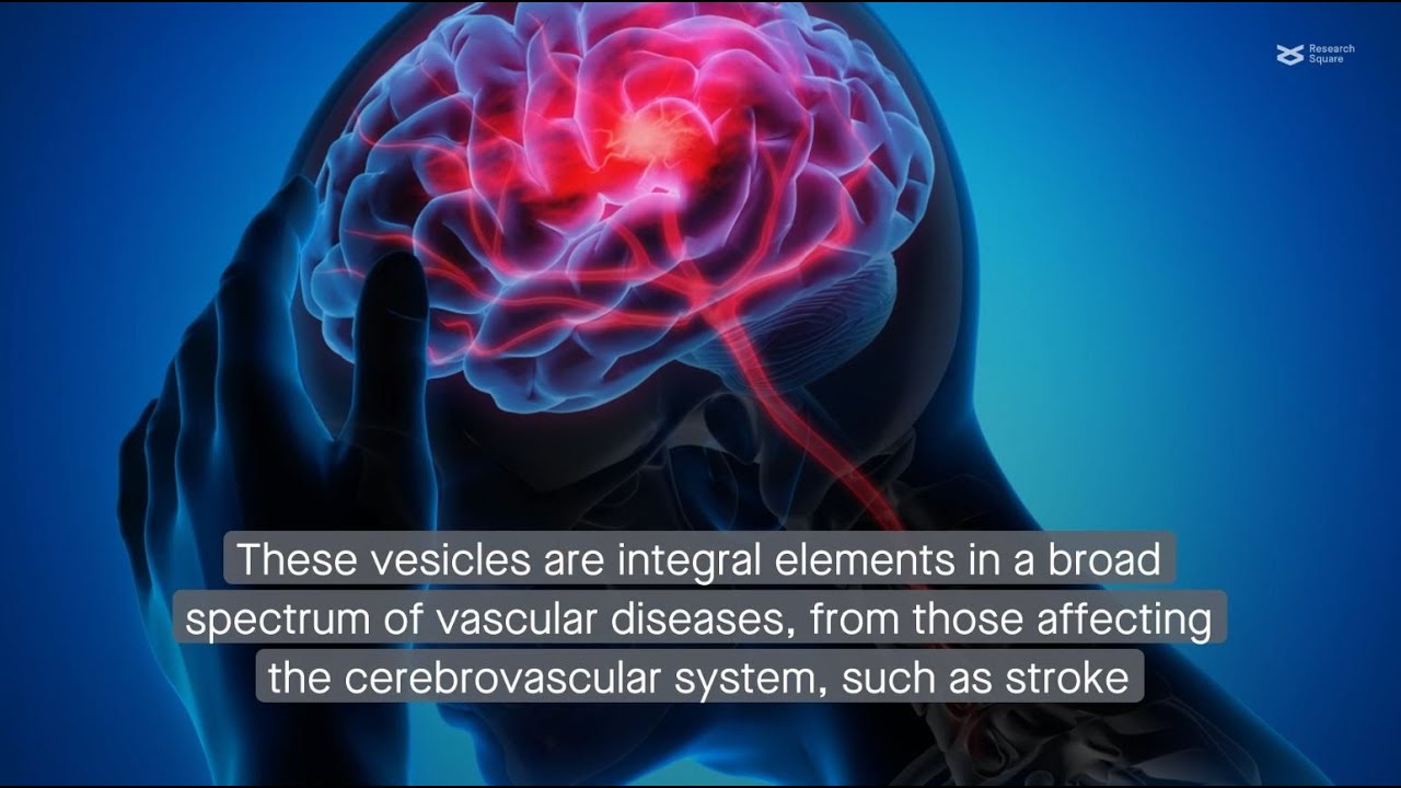 Decoding the roles of extracellular vesicles in vascular diseases - YouTube