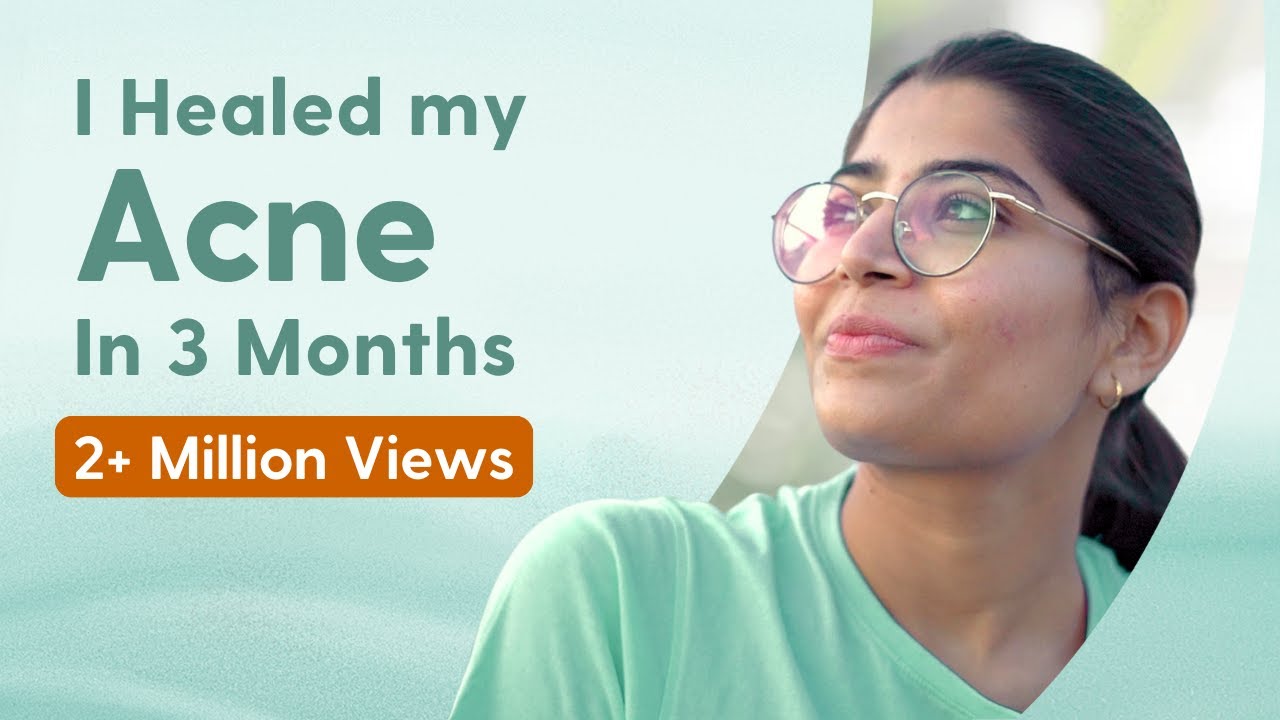 How I Healed my PIMPLES in Just 1 Month & Lost 22 Kgs