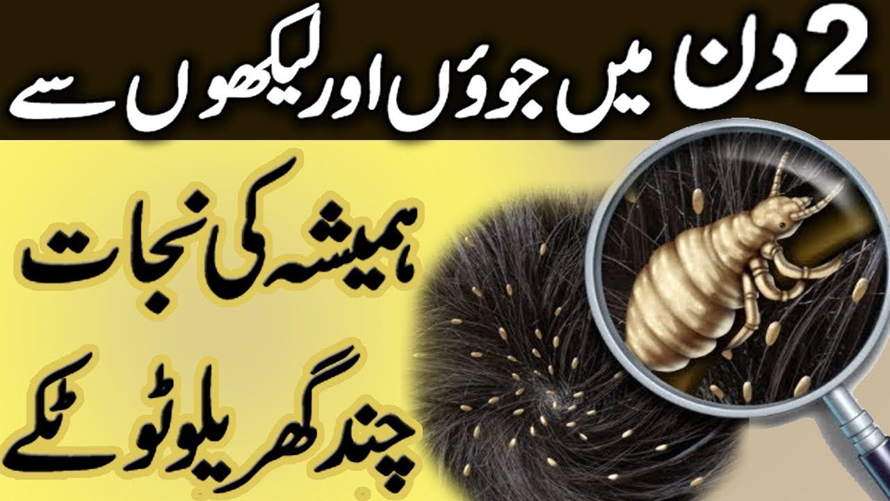 Juon or Likhon se Nijat   Anti Lice Treatment at Home  How to Get Rid of Head Lice