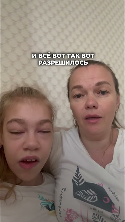 Mushukdagi bilyard toplarining fotosurati