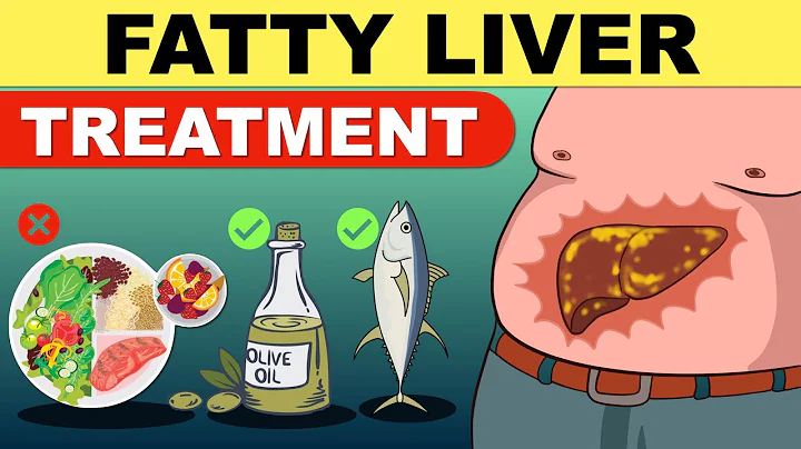 Fatty Liver Treatment | Fatty Liver Diet | Liver Detox | Fatty Liver | Fatty Liver Symptoms - DayDayNews