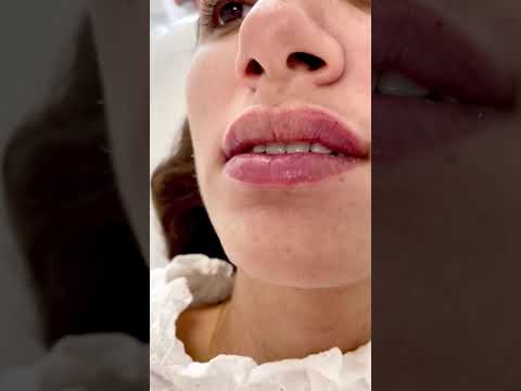 👄 𝐑𝐞𝐥𝐥𝐞𝐧𝐨 𝐝𝐞 𝐋𝐚𝐛𝐢𝐨𝐬 – 𝐑𝐞𝐬𝐮𝐥𝐭𝐚𝐝𝐨𝐬 𝐍𝐚𝐭𝐮𝐫𝐚𝐥𝐞𝐬