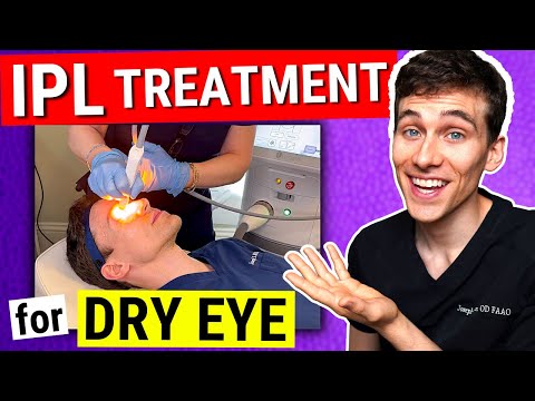 Lumenis IPL Dry Eye Treatment: Doctor Becomes the Patient!