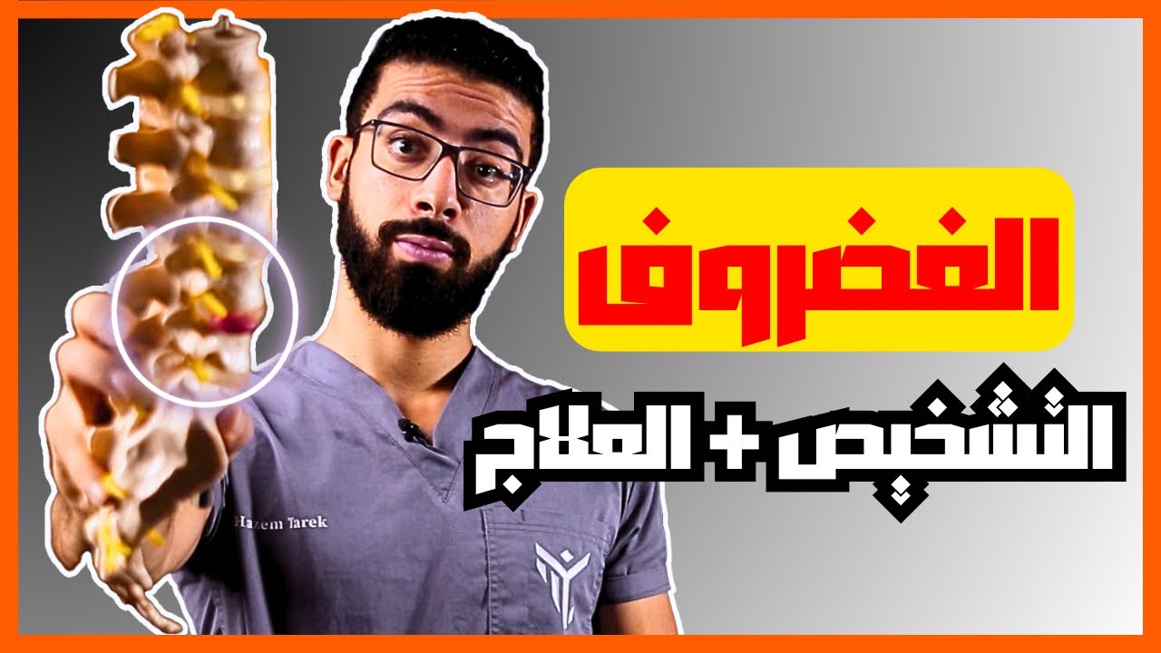 دكتور حازم طارق يوضح كيف تشخص نفسك بالانزلاق الغضروفي القطني | و التمرين السحرى لعلاج الم الديسك💯