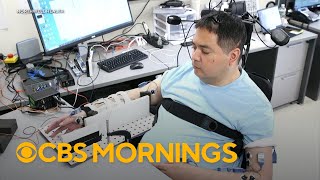 AI helps paralyzed man regain some feeling and movement in his arms