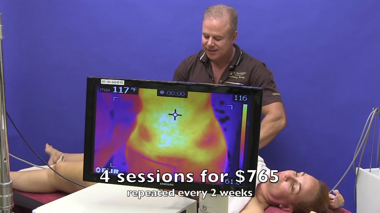 Venus Freeze on the Abdomen