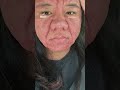 Woman's face completely changes during pregnancy
