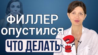 Филлер опустился вниз // Почему это произошло? Может ли филлер мигрировать?