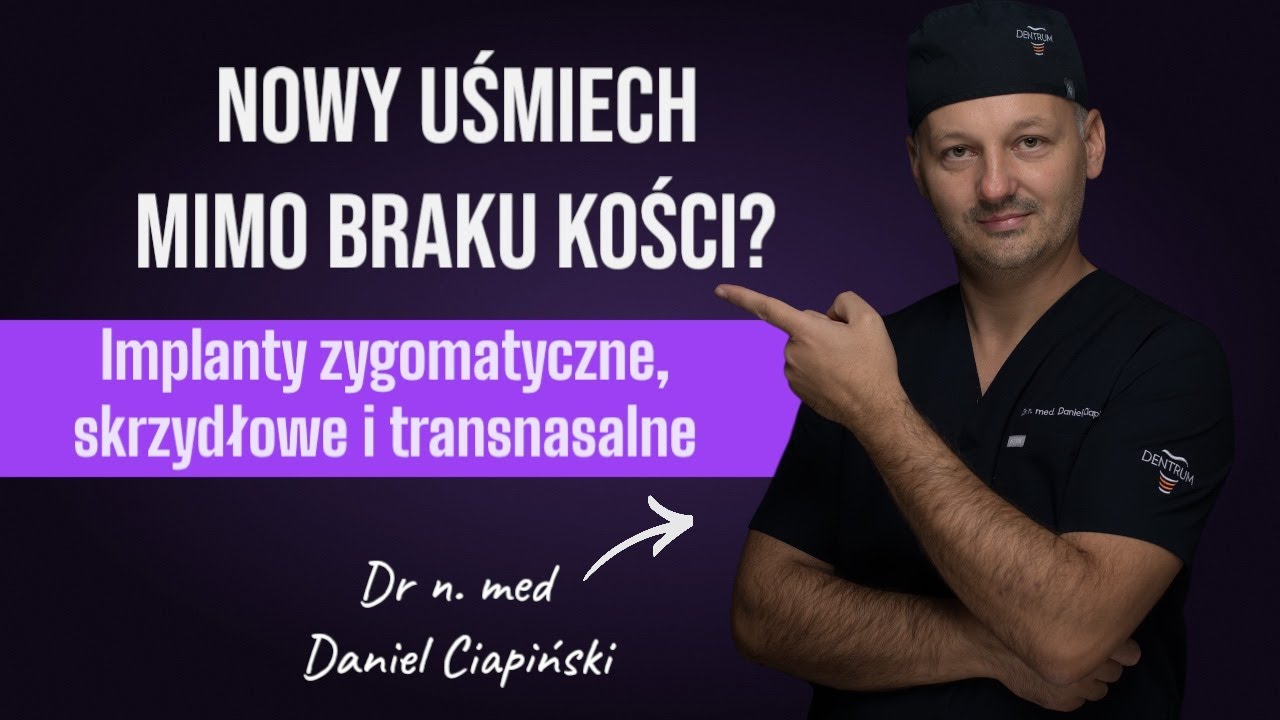 Nowy uśmiech mimo braku kości? Implanty Zygomatyczne, Skrzydłowe, Transnasalne
