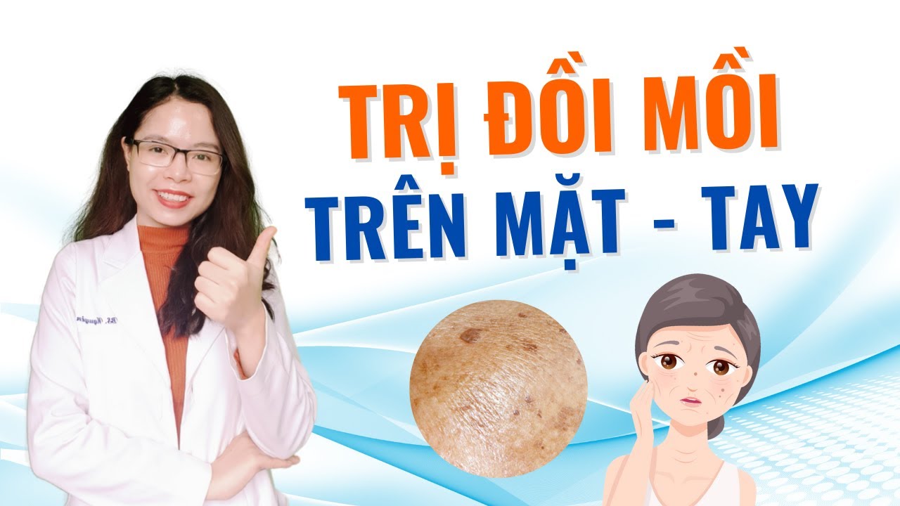 CÂU CÁ RÔ PHI TRỜI LẠNH: Mồi Câu Rô Phi