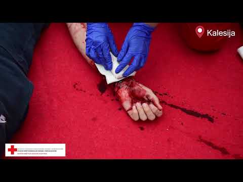 Video: Prva Pomoć Kod Krvarenja