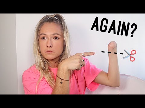 I Had To Get My Arm Amputated.. AGAIN // Amputee Storytime