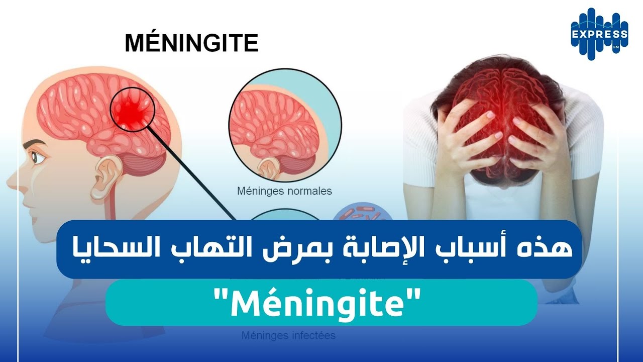 شكون يلزمو يلقح ضد التهاب السحايا؟