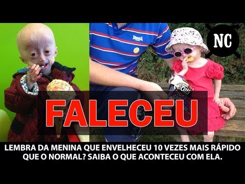 Video: Adalia Rose Nilai Bersih: Wiki, Berkahwin, Keluarga, Perkahwinan, Gaji, Adik Beradik