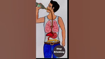 Thumbnail of Stop Drinking 🍾|#stopdrinkingalcohol #drinking #alcohol #alcoholism #drpoonammaggo