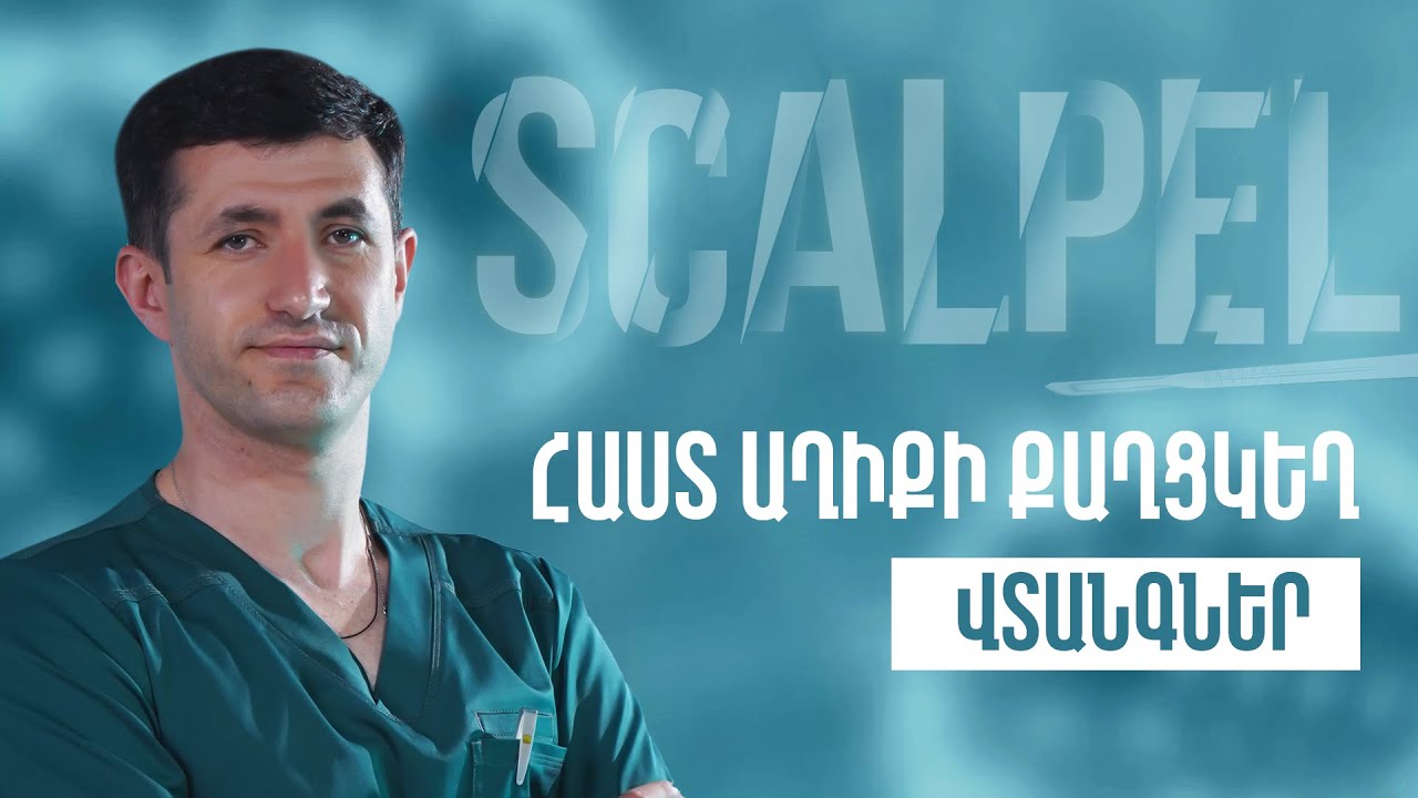 Հաստ աղիքի քաղցկեղ | Scalpel 03