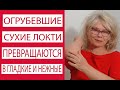 Делаю Это Раз в Неделю и У Меня Гладкие Локти/Сухие Огрубевшие Локти Станут Нежными и Молодыми