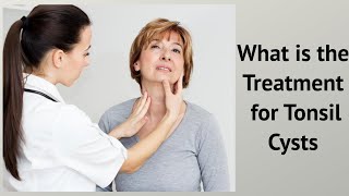 What is the Treatment for Tonsil Cysts Cyst Of Tonsil