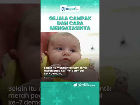 Video: Berapa lama roseola menular pada permukaan?