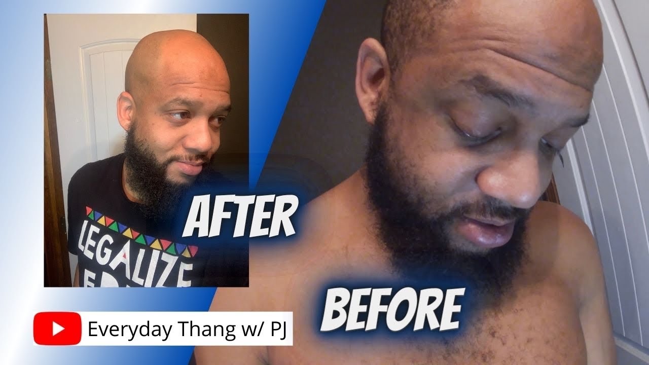 They Tried To Take My Life In A Fight / Freedom Grooming Shave