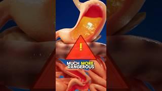 What Happens When You Swallow Two Opposite Magnets?