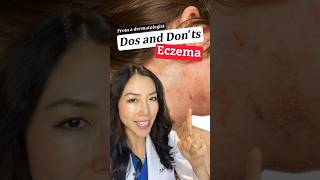 Eczema Dos ✅ and Don’ts ❌ #skincare #eczema
