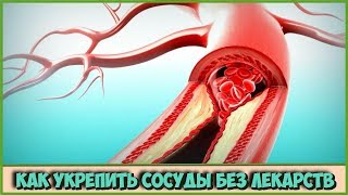 Как Сделать Сосуды Чистыми И Эластичными Продукты Для Очищения Сосудов От Бляшек Советы Для Здоровья