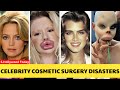 20 Celebrity Plastic Surgery Disasters – You’d Never Recognize Them Today | Then and Now 2025