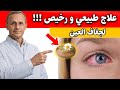 علاج جفاف العين طبيعي ا    طرق بسيطة  بدون قطرات    د  نور نجومي