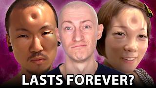 Japan's Deadly "Bagel Head" Disaster | Plastic Surgeon Reacts